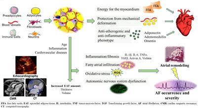 Epicardial Adipose Tissue and Cardiac Arrhythmias: Focus on Atrial Fibrillation